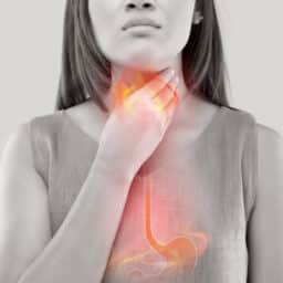 Woman with acid reflux